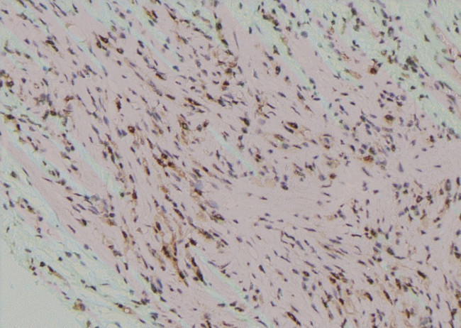 Phospho-mTOR (Ser2454) Antibody in Immunohistochemistry (Paraffin) (IHC (P))