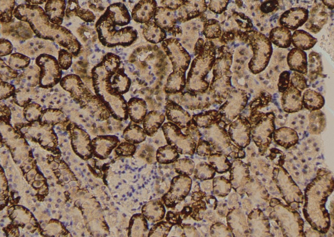 Phospho-mTOR (Ser2454) Antibody in Immunohistochemistry (Paraffin) (IHC (P))