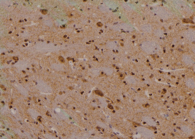 Phospho-mTOR (Ser2454) Antibody in Immunohistochemistry (Paraffin) (IHC (P))