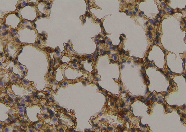 Phospho-WASP (Tyr291) Antibody in Immunohistochemistry (Paraffin) (IHC (P))