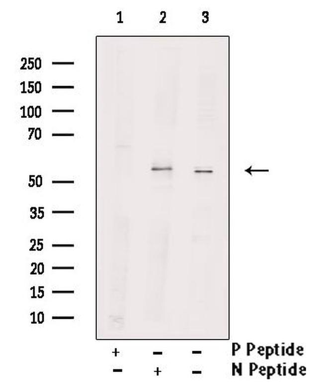 Phospho-WASP (Tyr291) Antibody in Western Blot (WB)