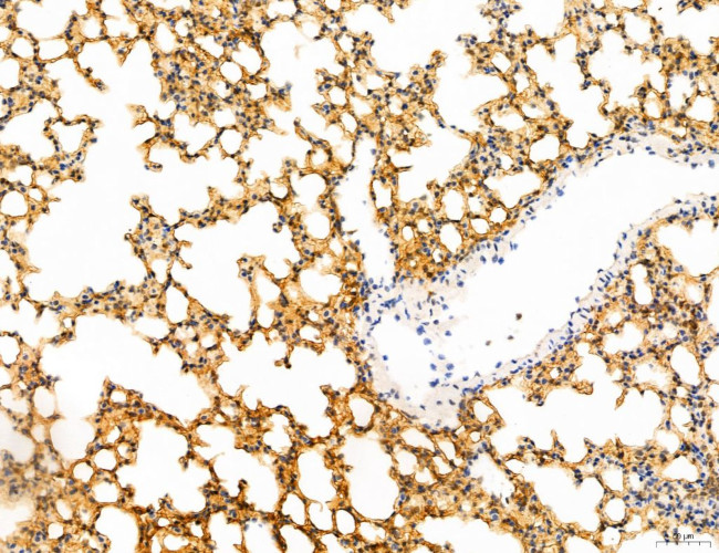 Phospho-WASP (Tyr291) Antibody in Immunohistochemistry (Paraffin) (IHC (P))