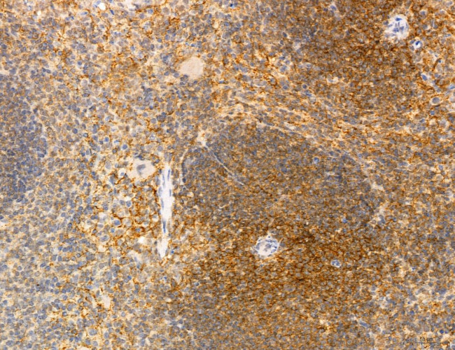 Phospho-WASP (Tyr291) Antibody in Immunohistochemistry (Paraffin) (IHC (P))