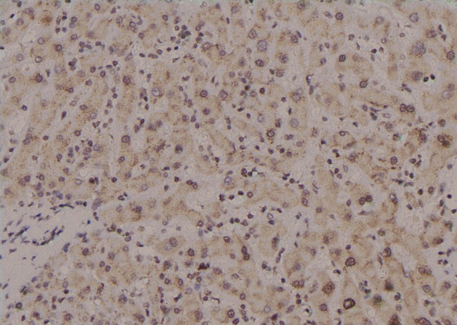 Phospho-CrkL (Tyr251) Antibody in Immunohistochemistry (Paraffin) (IHC (P))