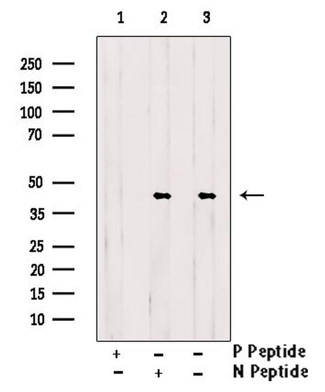 Phospho-CrkL (Tyr251) Antibody in Western Blot (WB)