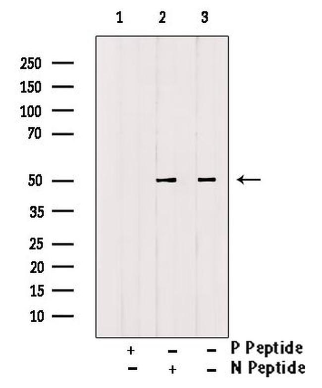 Phospho-beta Arrestin 1 (Tyr173) Antibody in Western Blot (WB)