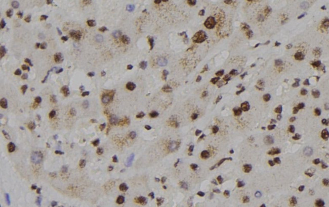 Phospho-GSK3 alpha (Ser282) Antibody in Immunohistochemistry (Paraffin) (IHC (P))