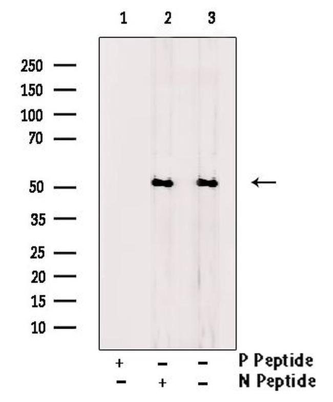 Phospho-GSK3 alpha (Ser282) Antibody in Western Blot (WB)