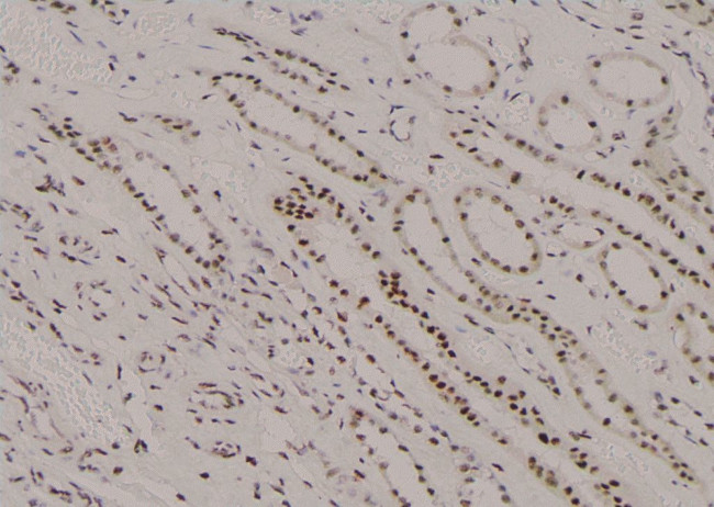 Phospho-CDK7 (Ser164) Antibody in Immunohistochemistry (Paraffin) (IHC (P))