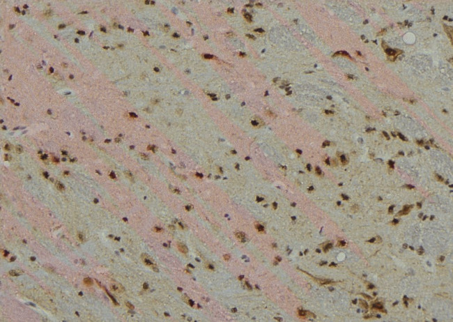 Phospho-CDK7 (Ser164) Antibody in Immunohistochemistry (Paraffin) (IHC (P))