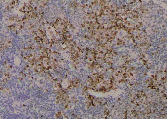 Phospho-CDK9 (Ser347) Antibody in Immunohistochemistry (Paraffin) (IHC (P))