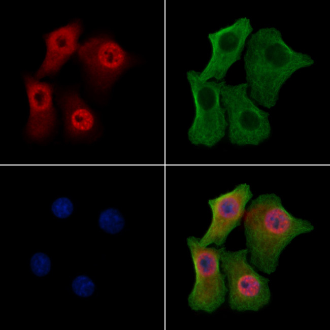 Phospho-BRCA2 (Ser2095) Antibody in Immunocytochemistry (ICC/IF)