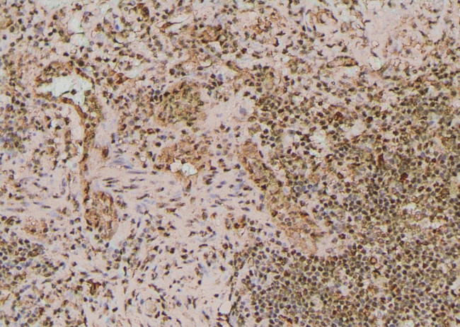 Phospho-BRCA2 (Ser2095) Antibody in Immunohistochemistry (Paraffin) (IHC (P))