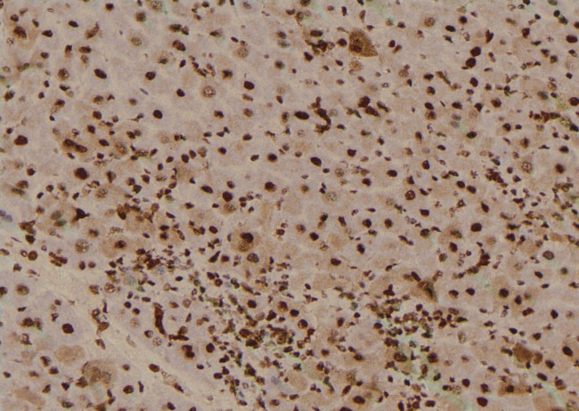 Phospho-BRCA2 (Ser2095) Antibody in Immunohistochemistry (Paraffin) (IHC (P))