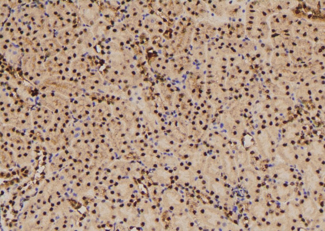 Phospho-RSK2 (Thr577) Antibody in Immunohistochemistry (Paraffin) (IHC (P))