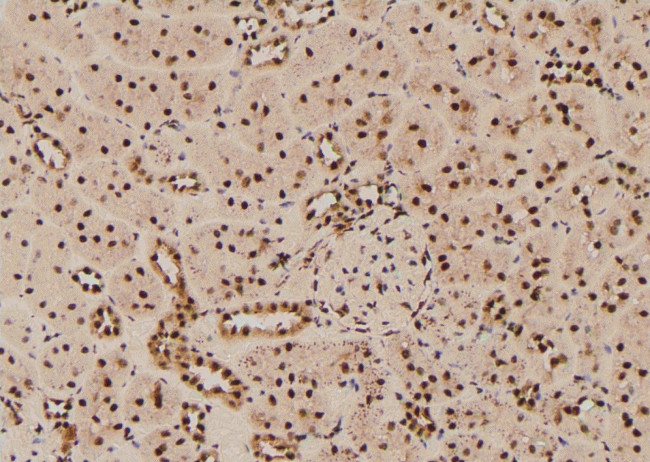 Phospho-RSK2 (Thr577) Antibody in Immunohistochemistry (Paraffin) (IHC (P))