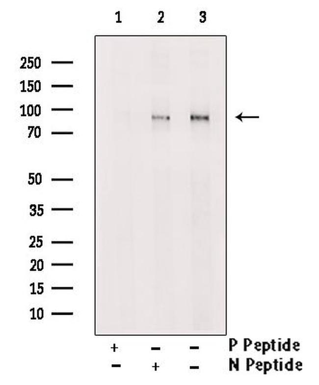 Phospho-RSK2 (Thr577) Antibody in Western Blot (WB)