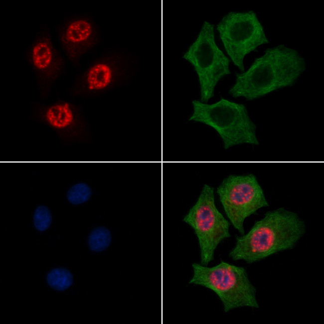 Phospho-RSK2 (Thr577) Antibody in Immunocytochemistry (ICC/IF)