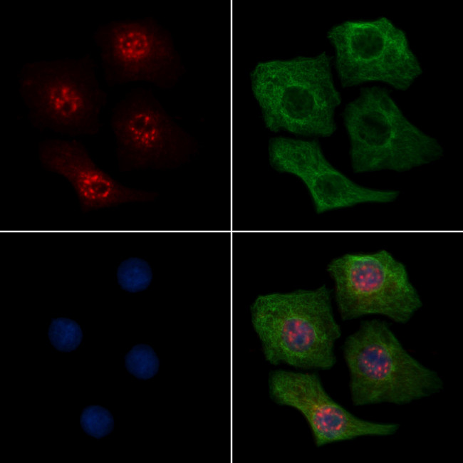 Phospho-MEK6 (Thr28) Antibody in Immunocytochemistry (ICC/IF)