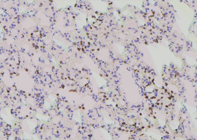 Phospho-PLK1 (Tyr217) Antibody in Immunohistochemistry (Paraffin) (IHC (P))