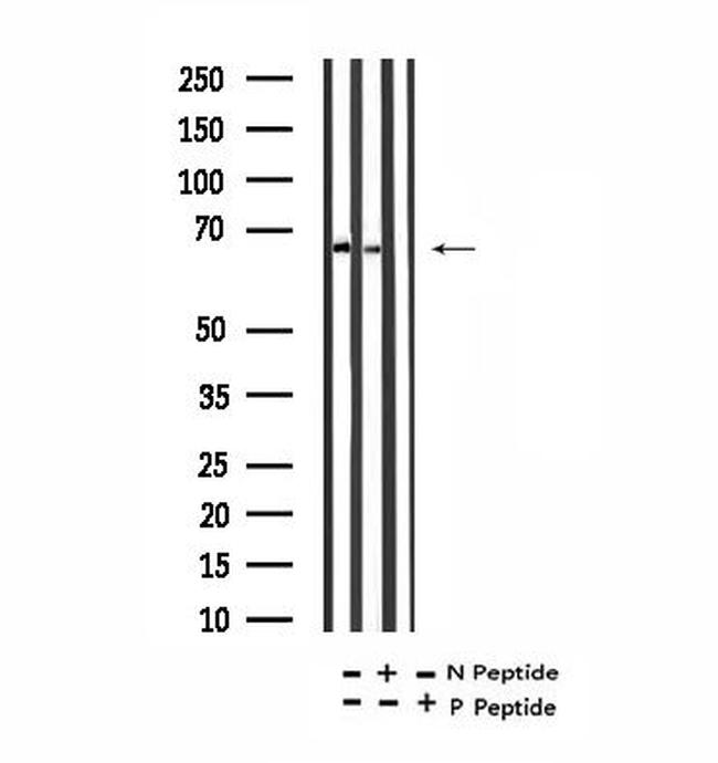 Phospho-PLK1 (Tyr217) Antibody in Western Blot (WB)