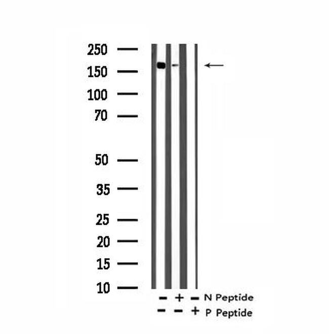 Phospho-Afadin (Tyr1230) Antibody in Western Blot (WB)