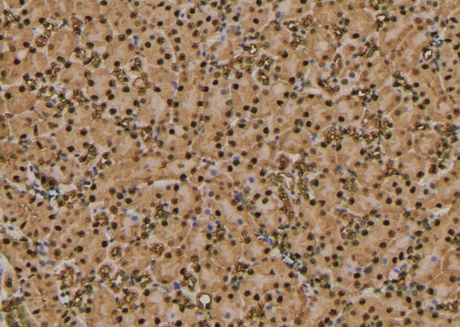 Phospho-RHOA (Thr100) Antibody in Immunohistochemistry (Paraffin) (IHC (P))