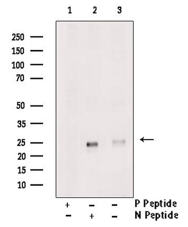 Phospho-RHOA (Thr100) Antibody in Western Blot (WB)