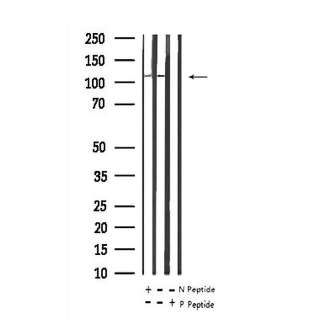 Phospho-PSD-95 (Ser142) Antibody in Western Blot (WB)