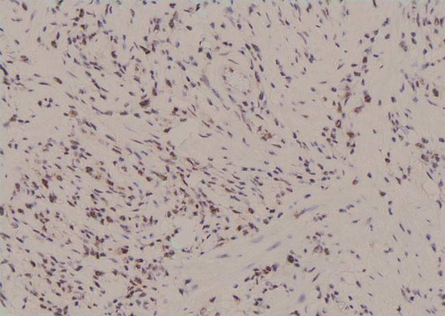 Phospho-RUNX1 (Ser397) Antibody in Immunohistochemistry (Paraffin) (IHC (P))