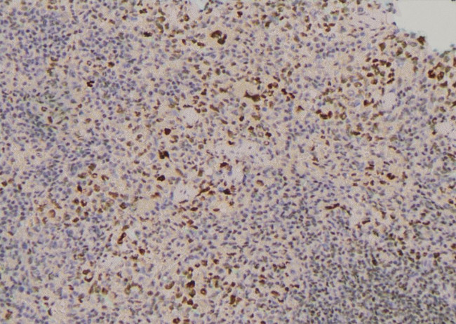 Phospho-RUNX1 (Ser397) Antibody in Immunohistochemistry (Paraffin) (IHC (P))