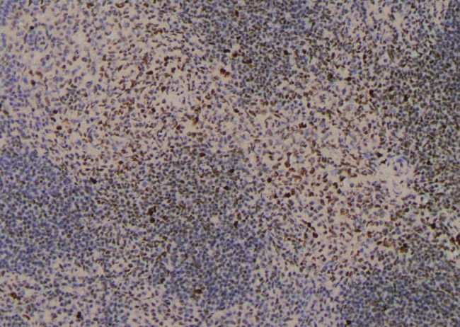 Phospho-MEF2A (Ser479) Antibody in Immunohistochemistry (Paraffin) (IHC (P))