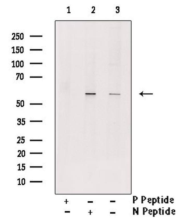 Phospho-MEF2A (Ser479) Antibody in Western Blot (WB)