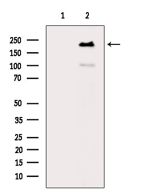 Phospho-EIF4G1 (Ser1147) Antibody in Western Blot (WB)