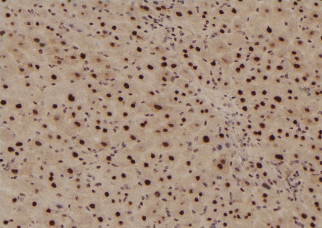 Phospho-EIF4G1 (Ser1185) Antibody in Immunohistochemistry (Paraffin) (IHC (P))