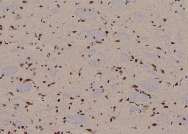 Phospho-EIF4G1 (Ser1185) Antibody in Immunohistochemistry (Paraffin) (IHC (P))