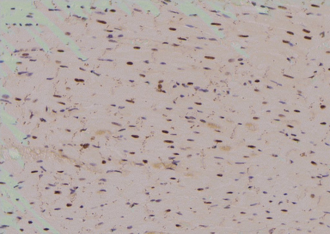 Phospho-EIF4G1 (Ser1185) Antibody in Immunohistochemistry (Paraffin) (IHC (P))