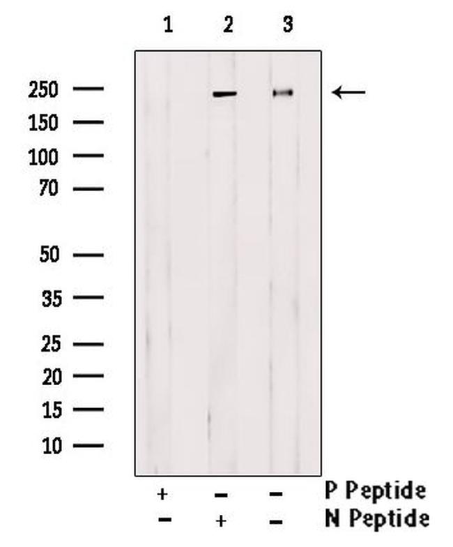 Phospho-EIF4G1 (Ser1185) Antibody in Western Blot (WB)