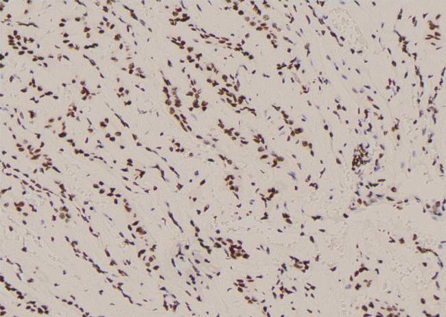 Phospho-SHP2 (Tyr62) Antibody in Immunohistochemistry (Paraffin) (IHC (P))