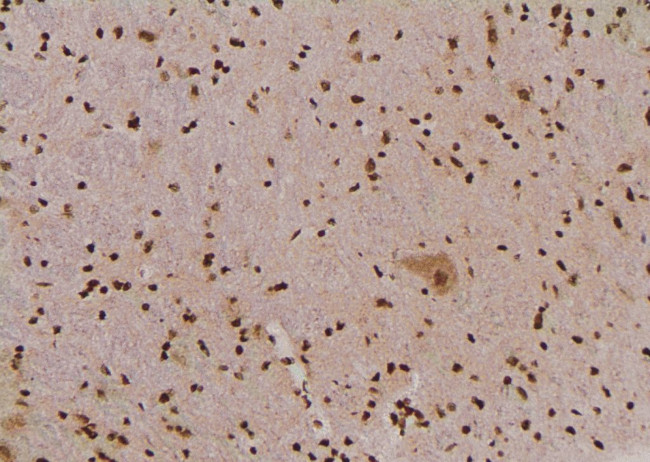 Phospho-SHP2 (Tyr62) Antibody in Immunohistochemistry (Paraffin) (IHC (P))