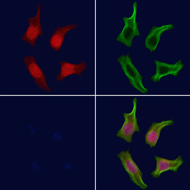 Phospho-Btk (Tyr344) Antibody in Immunocytochemistry (ICC/IF)