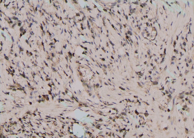 Phospho-Btk (Tyr344) Antibody in Immunohistochemistry (Paraffin) (IHC (P))