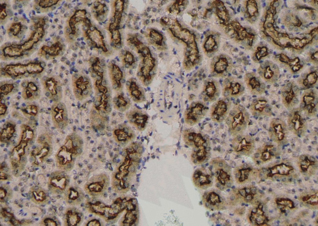 Phospho-Btk (Tyr344) Antibody in Immunohistochemistry (Paraffin) (IHC (P))