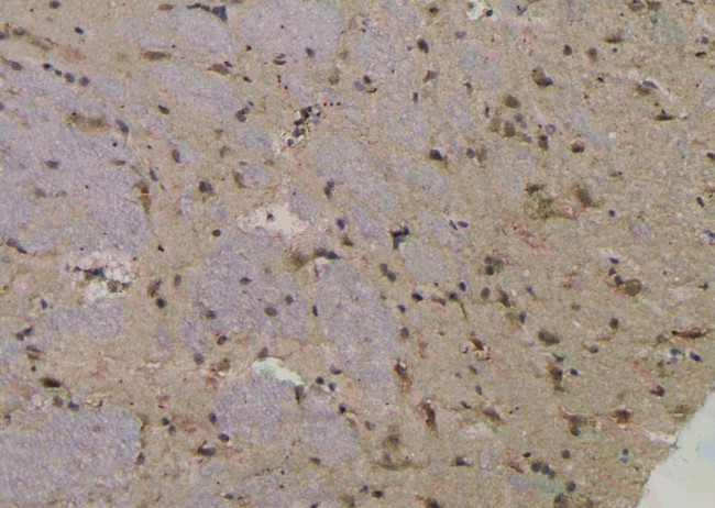 Phospho-Btk (Tyr344) Antibody in Immunohistochemistry (Paraffin) (IHC (P))