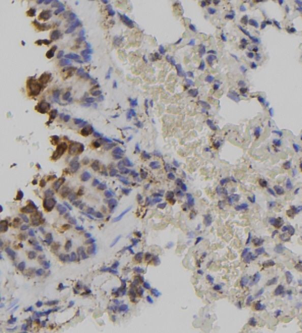 Phospho-Btk (Tyr344) Antibody in Immunohistochemistry (Paraffin) (IHC (P))