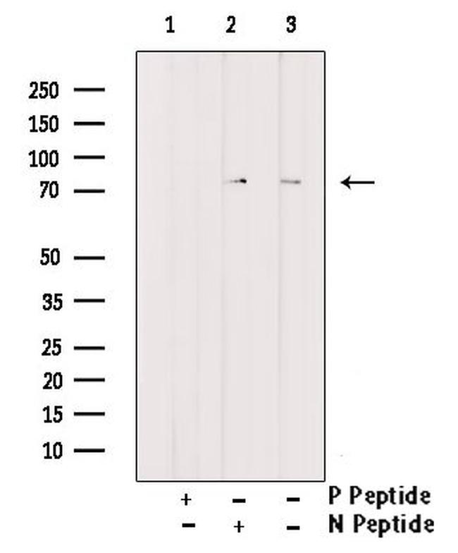 Phospho-Btk (Tyr344) Antibody in Western Blot (WB)