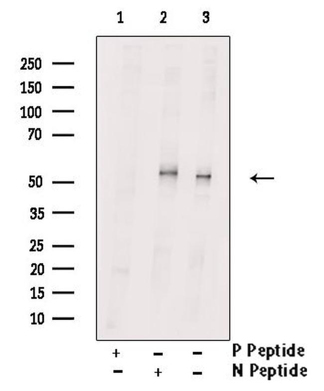 Phospho-MEF2C (Ser459) Antibody in Western Blot (WB)