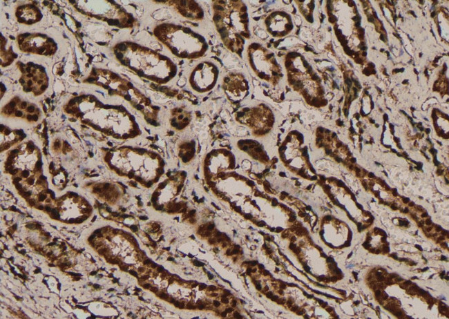 Phospho-PRDX1 (Ser196) Antibody in Immunohistochemistry (Paraffin) (IHC (P))