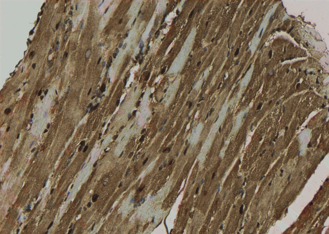 Phospho-PRDX1 (Ser196) Antibody in Immunohistochemistry (Paraffin) (IHC (P))