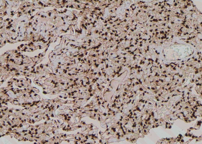 Phospho-ACK1 (Tyr284) Antibody in Immunohistochemistry (Paraffin) (IHC (P))